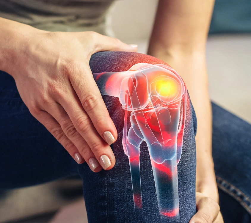 Woman holding knee with visible pain.